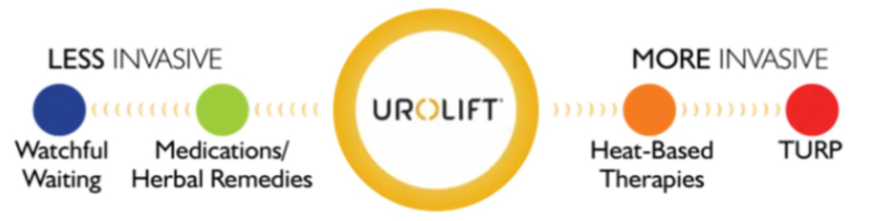 urolift-image3