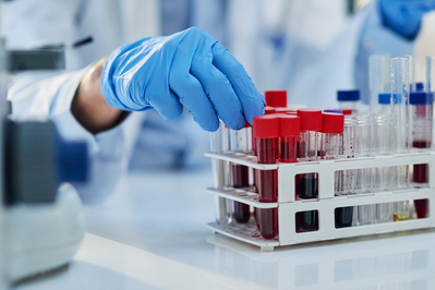 testosterone replacement therapy tests